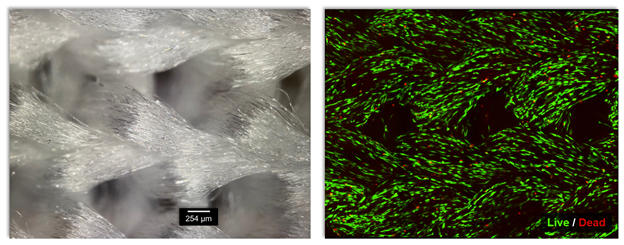 Left is a close-up of an interlock knit without cells and on the right the knit seeded with growing mesenchymal stem cells from a mouse. The green and red spots indicate live and dead cells respectively.  © Lani Lee, MIT. 